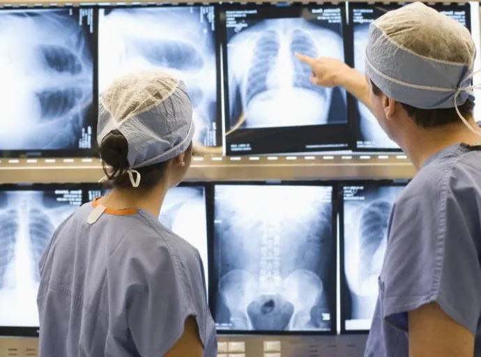 Novo protocolo no SUS visa ampliar acesso à cirurgia torácica no tratamento do câncer de pulmão